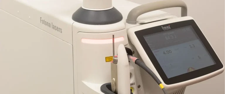 Fotona Laser Hand Rejuvenation