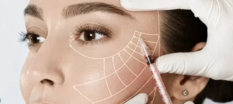 Sculptra®