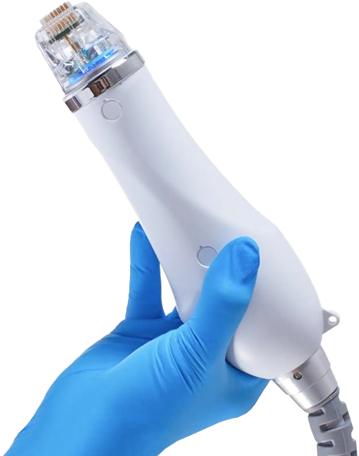 Secret RF microneedling treatment