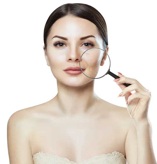 RF skin resurfacing treatment