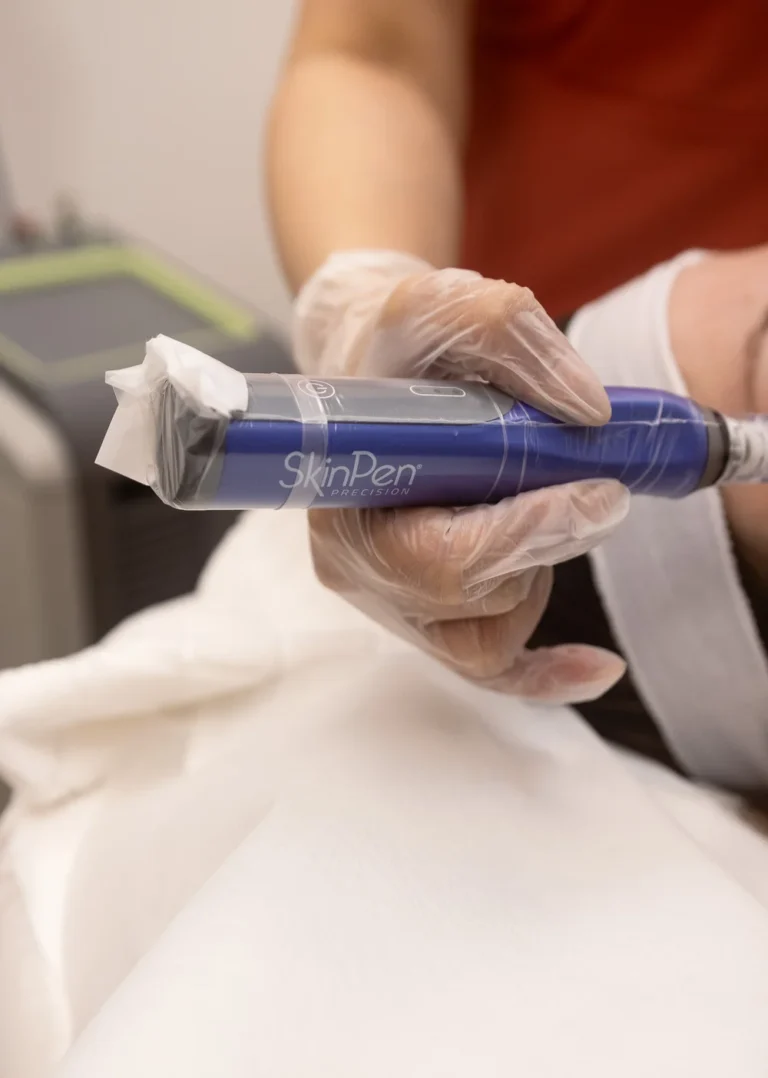 Microneedling with Vitamins and Minerals